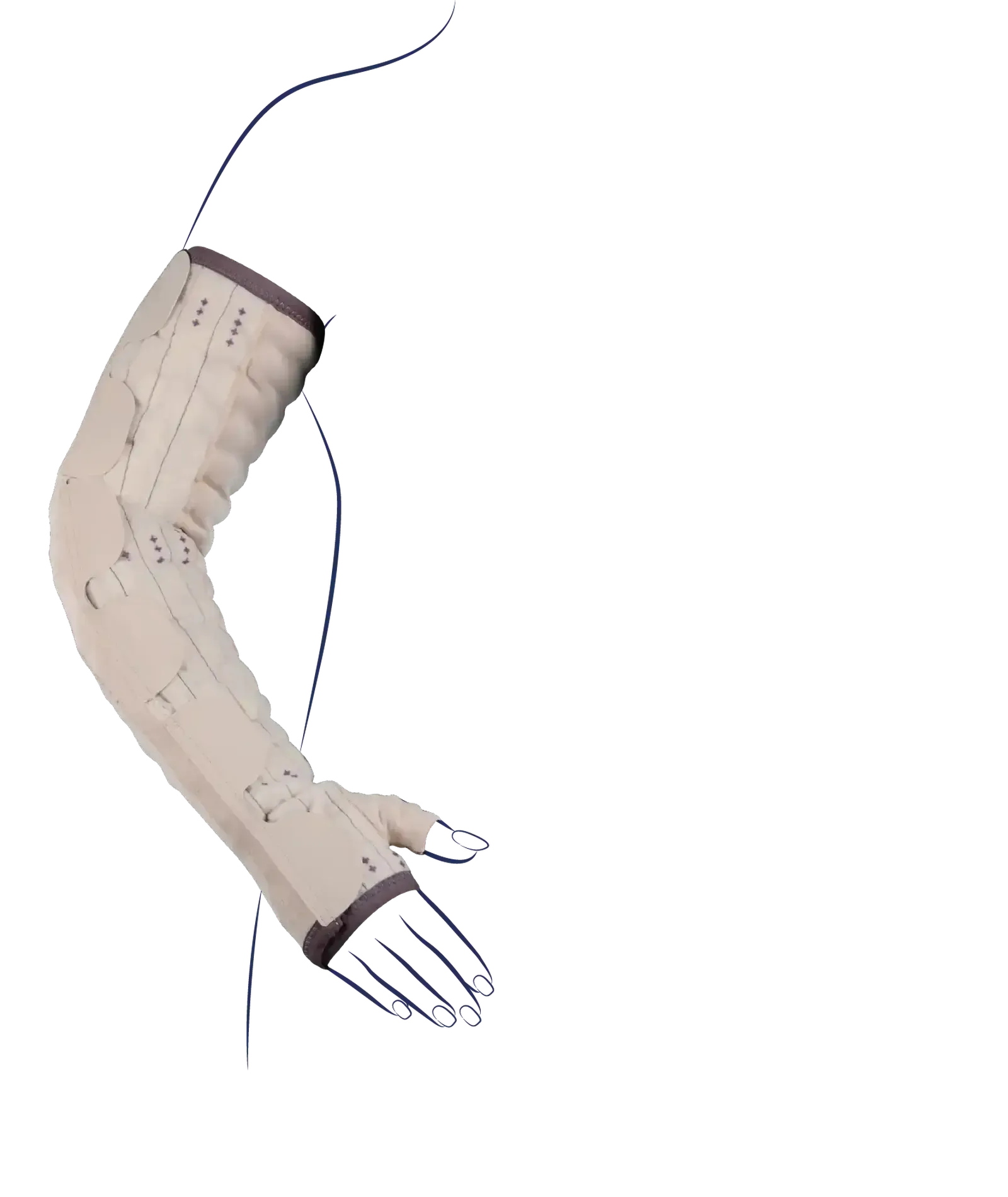 Vue du manchon MOBIDERM® Autofit Thuasne ajustable pour le membre supérieur
